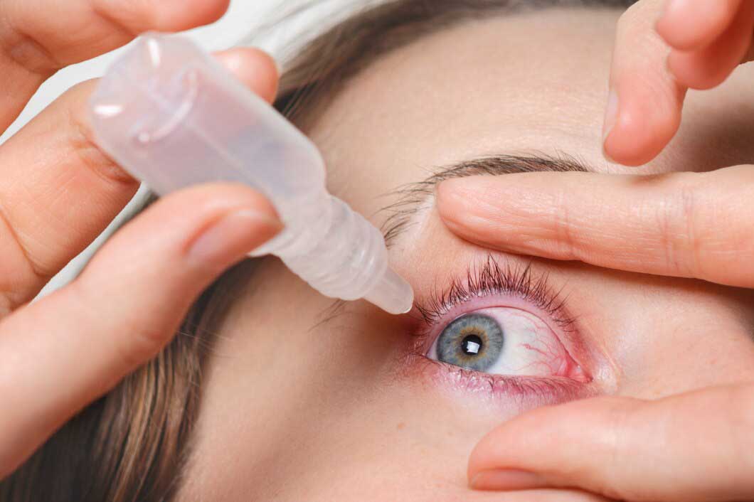 online care for pink eye-1