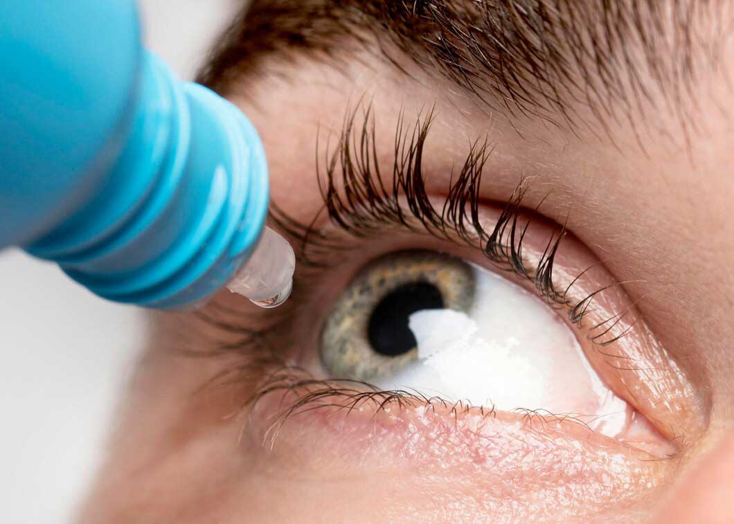 online care for pink eye-2